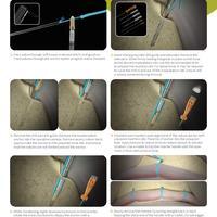 MICRORAPTOR KNOTLESS Hip Reference Guide
