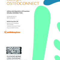 42455-it V1 Mini-Open Latarjet DOUBLE ENDOBUTTON TG Garofalo 0224