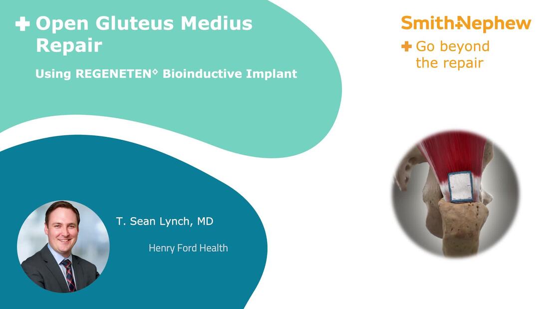 Open gluteus medius repair using REGENETEN Implant featuring: Dr. Lynch
