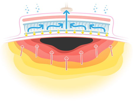 20250325_PICONHW_DeeperWound