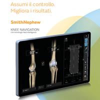 Real Intellignce Knee broch 22099-it V1 0420.pdf