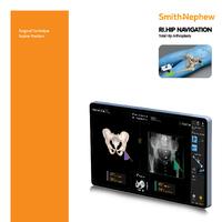 RI.HIP NAVIGATION Supine Position Surgical Technique