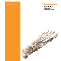 VLP FOOT Surgical Technique