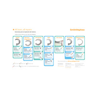 36638-2-es_V1-Meniscus-video-technique-tear-type-external-digital-0223.pdf