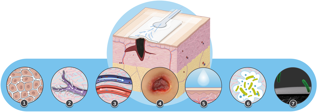 20250319_PICONHW_MoAOverview