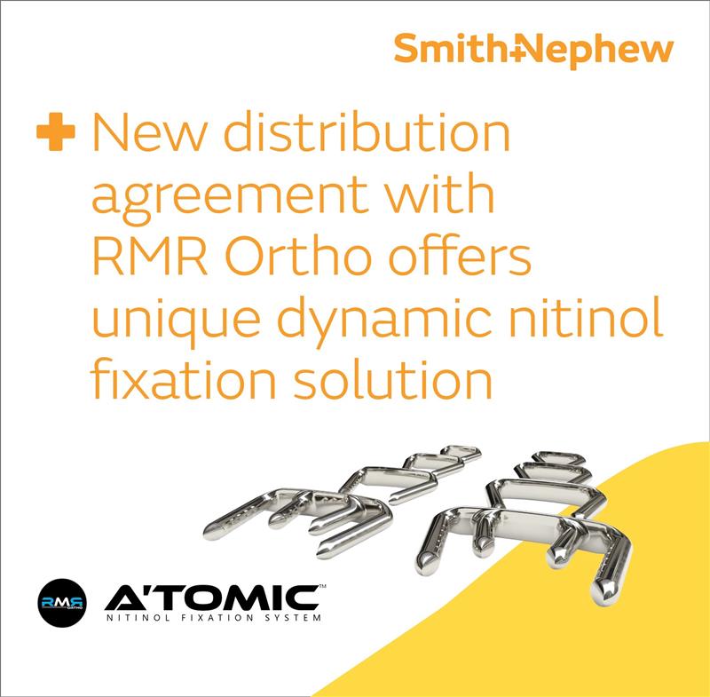 New distribution agreement with RMR Ortho offers unique dynamic nitinol fixation solution