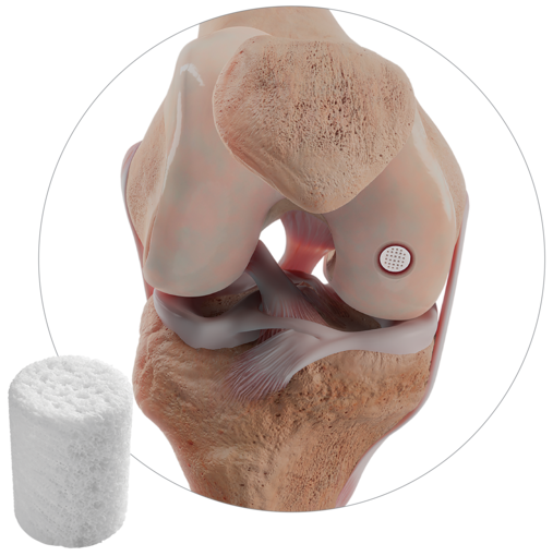 CARTIHEAL Procedure page Hero Image.png