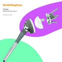 TITAN Modular Total Shoulder System | Smith+Nephew Global