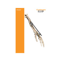 JET-X DISTAL RADIUS Surgical Technique