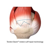 Tendon Seam 1.jpg
