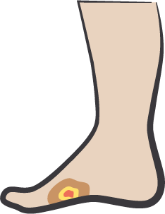 BROAD-RANGE-OF-WOUNDS-ICON@300x