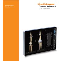 RI.KNEE NAVIGATION Femur First Surgical Technique