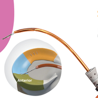 30yrs meniscal repair + FFF with PI and logo email banner-purple