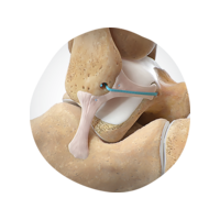 ULTRABRACE Hero 2.png