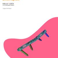 HALLU-LOCK Surgical Technique