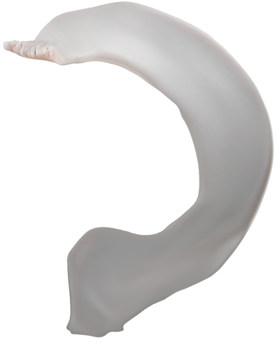 04_Root_PreOp_Meniscus_01_01.png