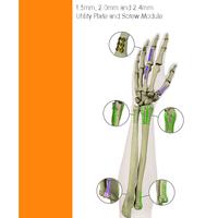 VLP MINI-MOD Hand and Wrist Surgical Technique