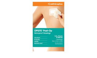 opsite-post-op-317x192.png