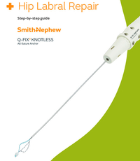 Q-FIX KNOTLESS Hip Labral Repair Technique Guide