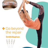 Hip QFKL Q-FIX Family Brochure