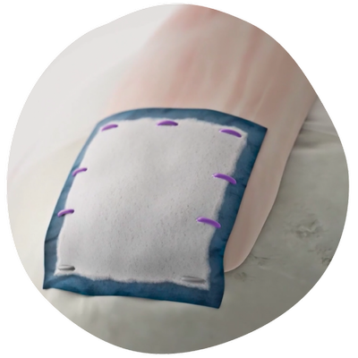 20250603_SPMPortfolio Rotator-cuff-tear-anatomy-image.png