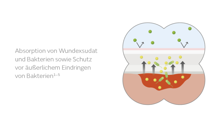 Allevyn Bacteria Lock Bild 1