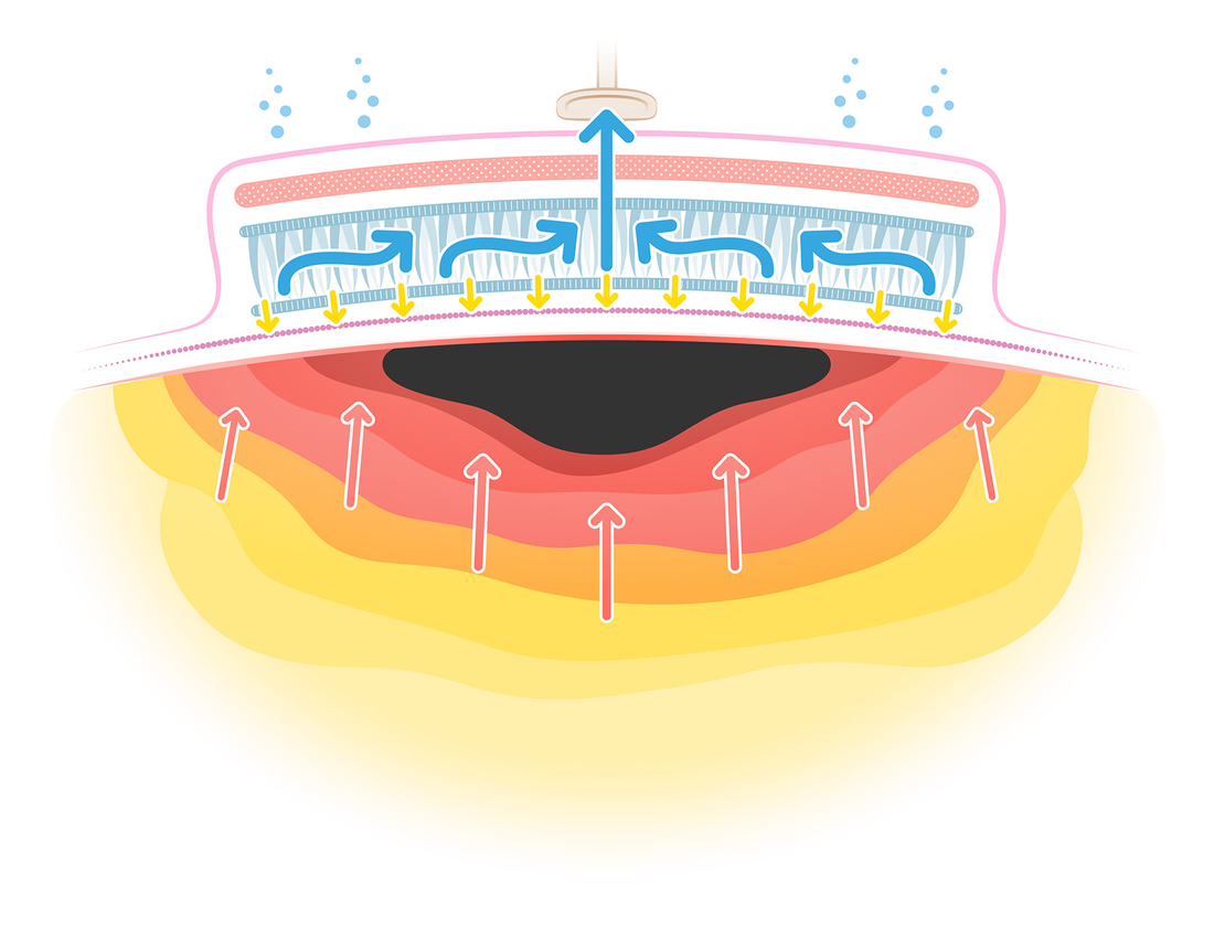 20250325_PICONHW_DeeperWound