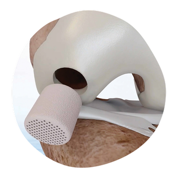 cartiheal_cutout_small.psd