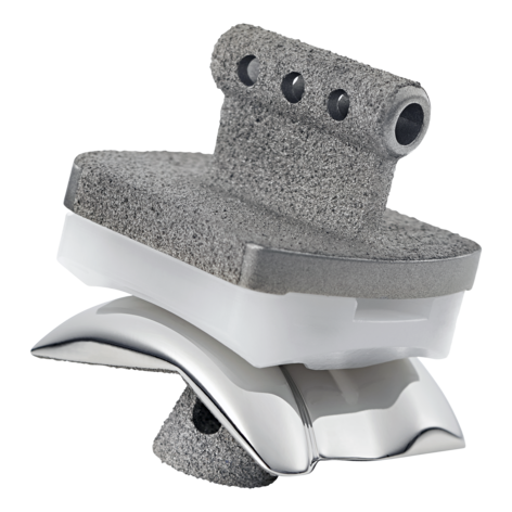 SALTO TALARIS Total Ankle Prosthesis | Smith+Nephew Global